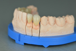 �������ȫ�ɹ�