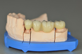 �ܸ����￾�ɹ�