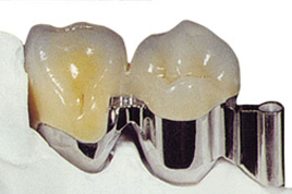 ˨��ʽ���ܸ���