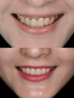 �ͻ�ʵ֤֮��