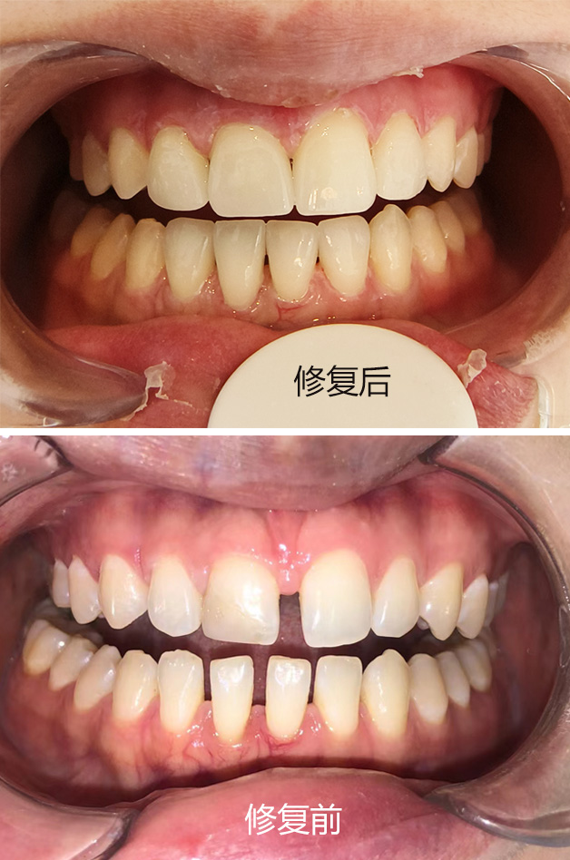 �����մ������޸�����